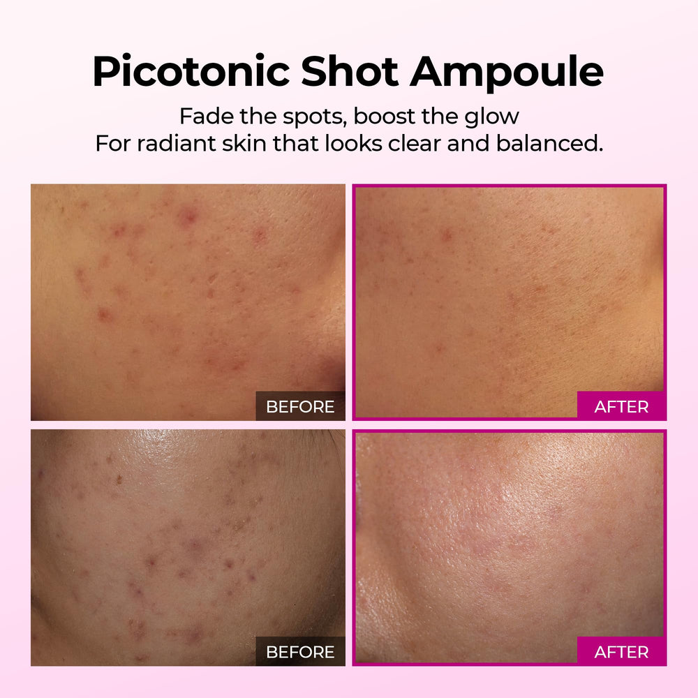 Dr.Melaxin Sérum Calcium Shot : application facile pour uniformiser le teint.