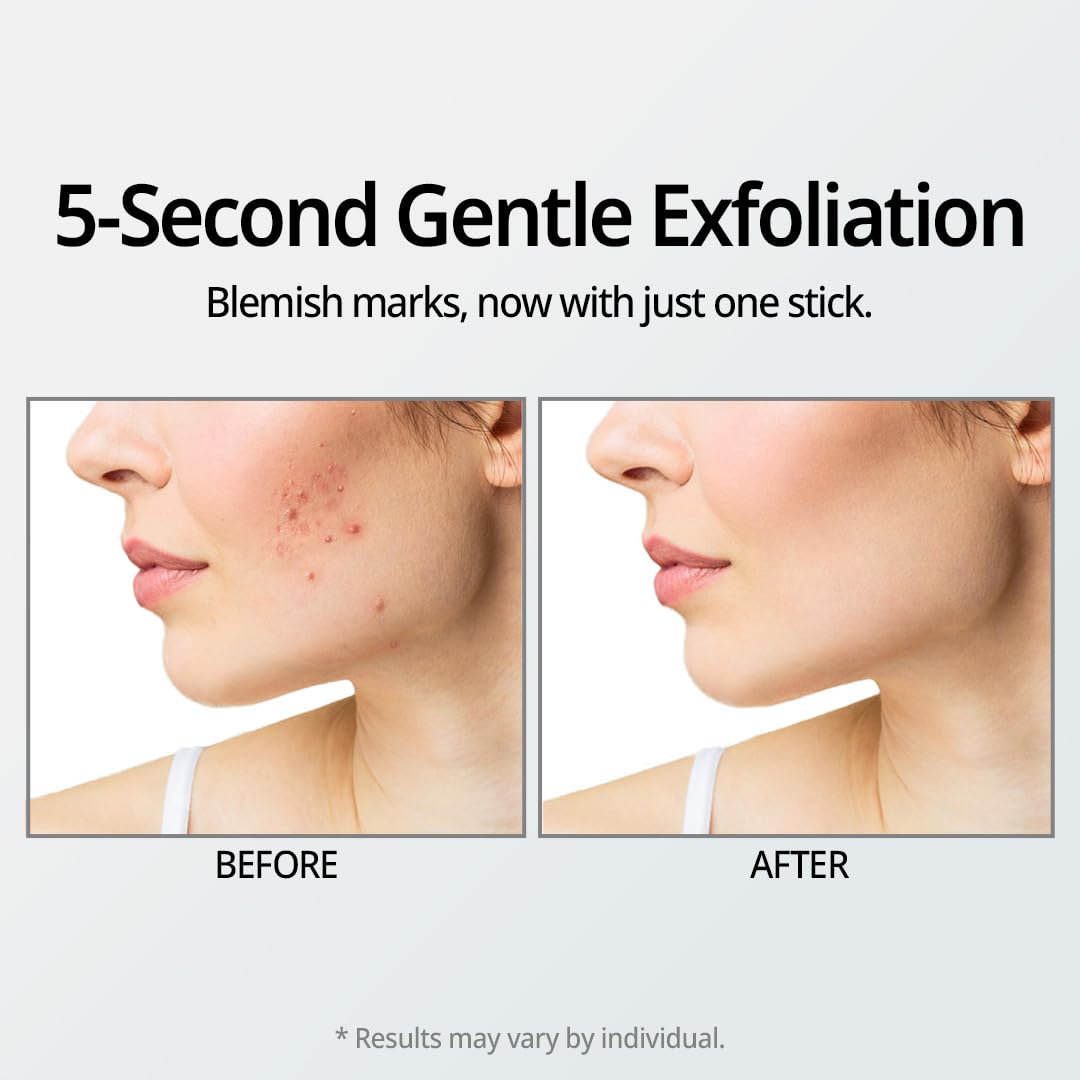 DR.ORACLE Stay A-Thera exfoliant en stick pour peau sensible et pores nets.