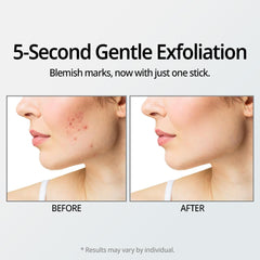 DR.ORACLE Stay A-Thera exfoliant en stick pour peau sensible et pores nets.