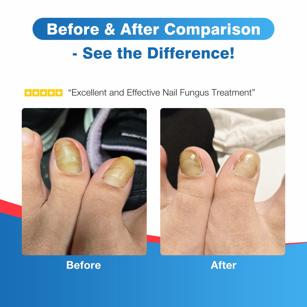 DR.RAPID Pénétration profonde – cible la partie atteinte des ongles