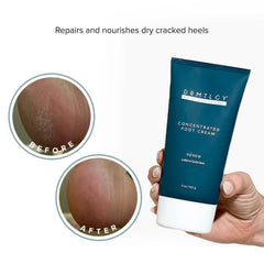DRMTLGY Crème Pieds Céramides Urée : soutien durable de l'hydratation.