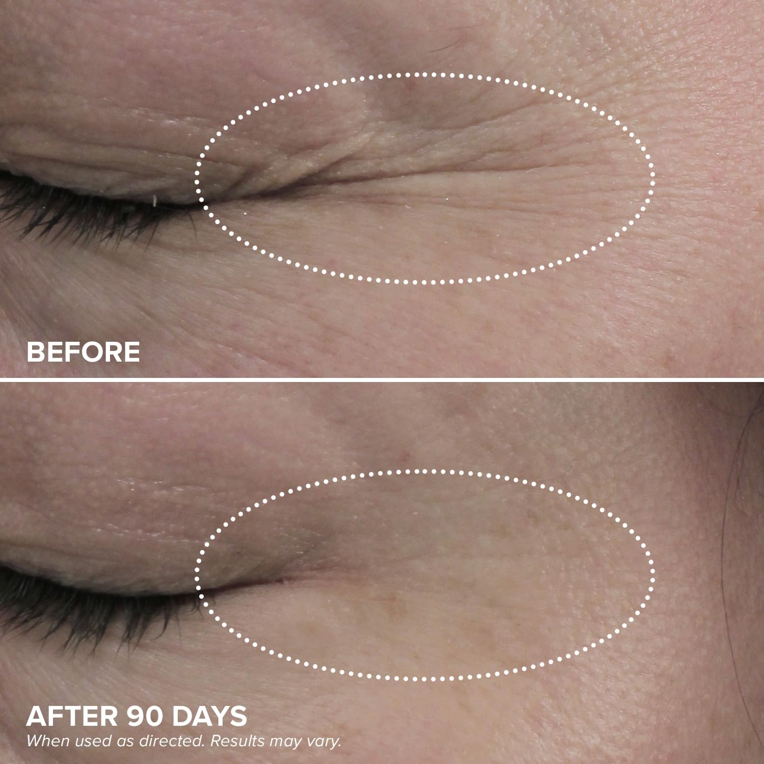 DRMTLGY HPR Contour des yeux, éclat et fraîcheur possibles.