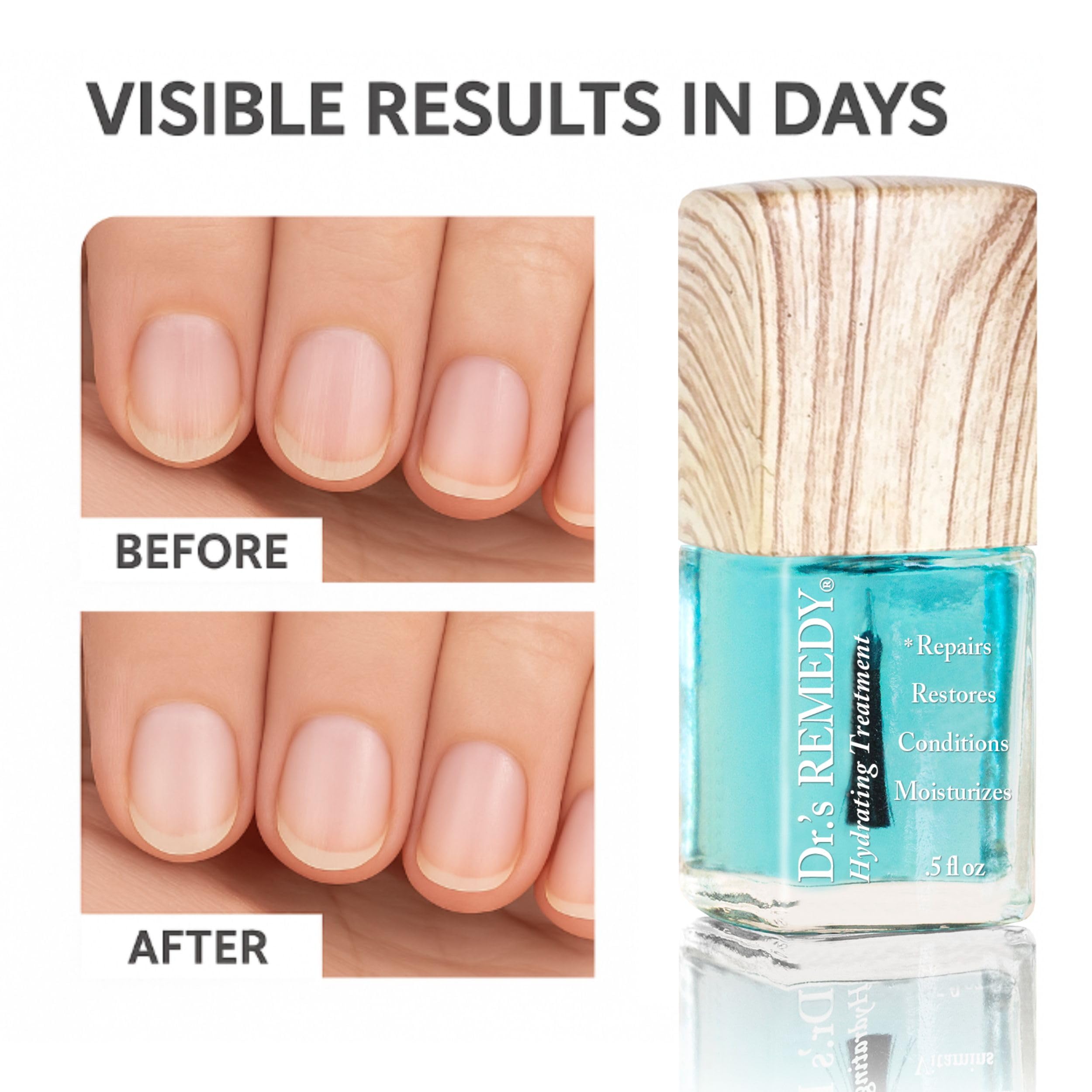 Dr.'s Remedy Formule Deux-en-Un – soin polyvalent pour ongles et cuticules.