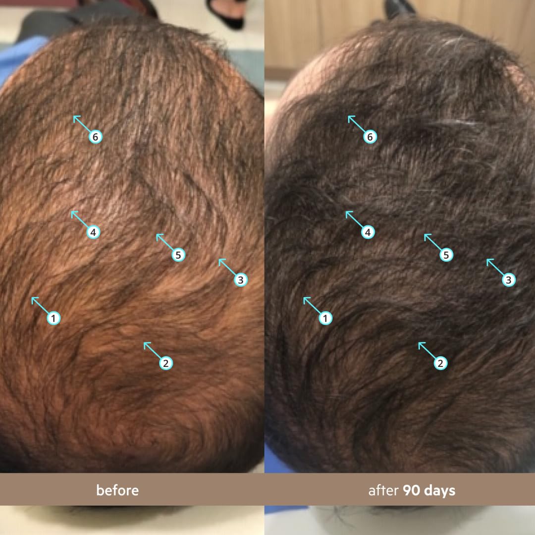 Application ciblée sur cuir chevelu pour routine quotidienne.