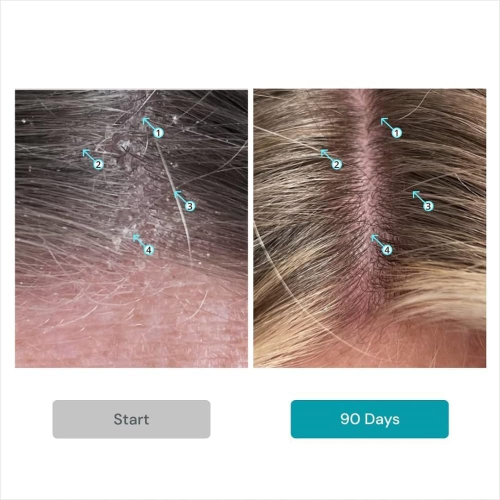 DS Laboratories Dandrene cheveux apres lavage douceur et brillance