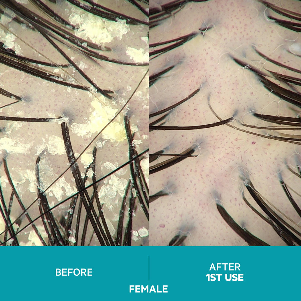 DS Labs Dandrene – Formulation sans sulfates, adaptée aux cheveux colorés.