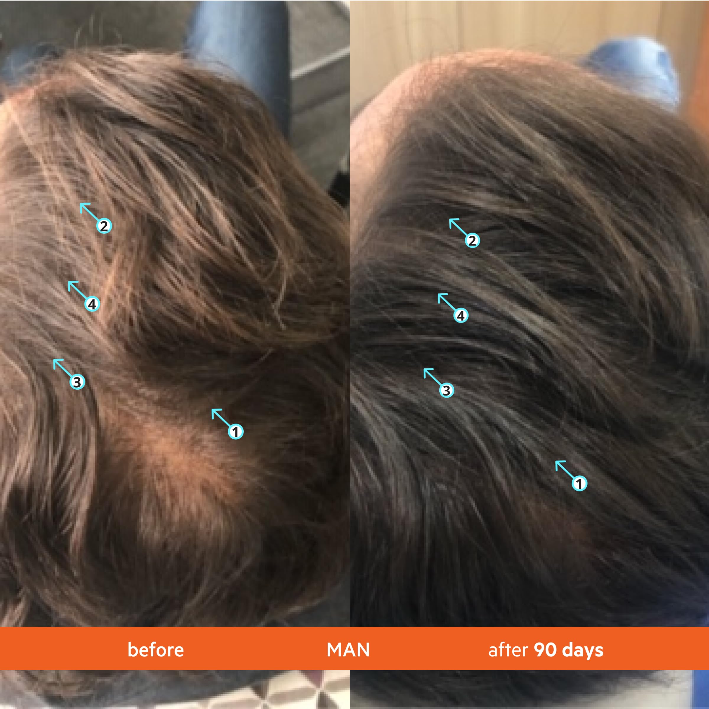 Cheveux après lavage avec Revita – apparence vivante et mouvement naturel.