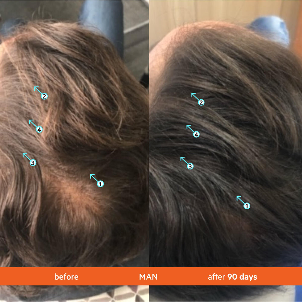 Shampoing Revita : texture crémeuse qui nettoie en douceur les cheveux.