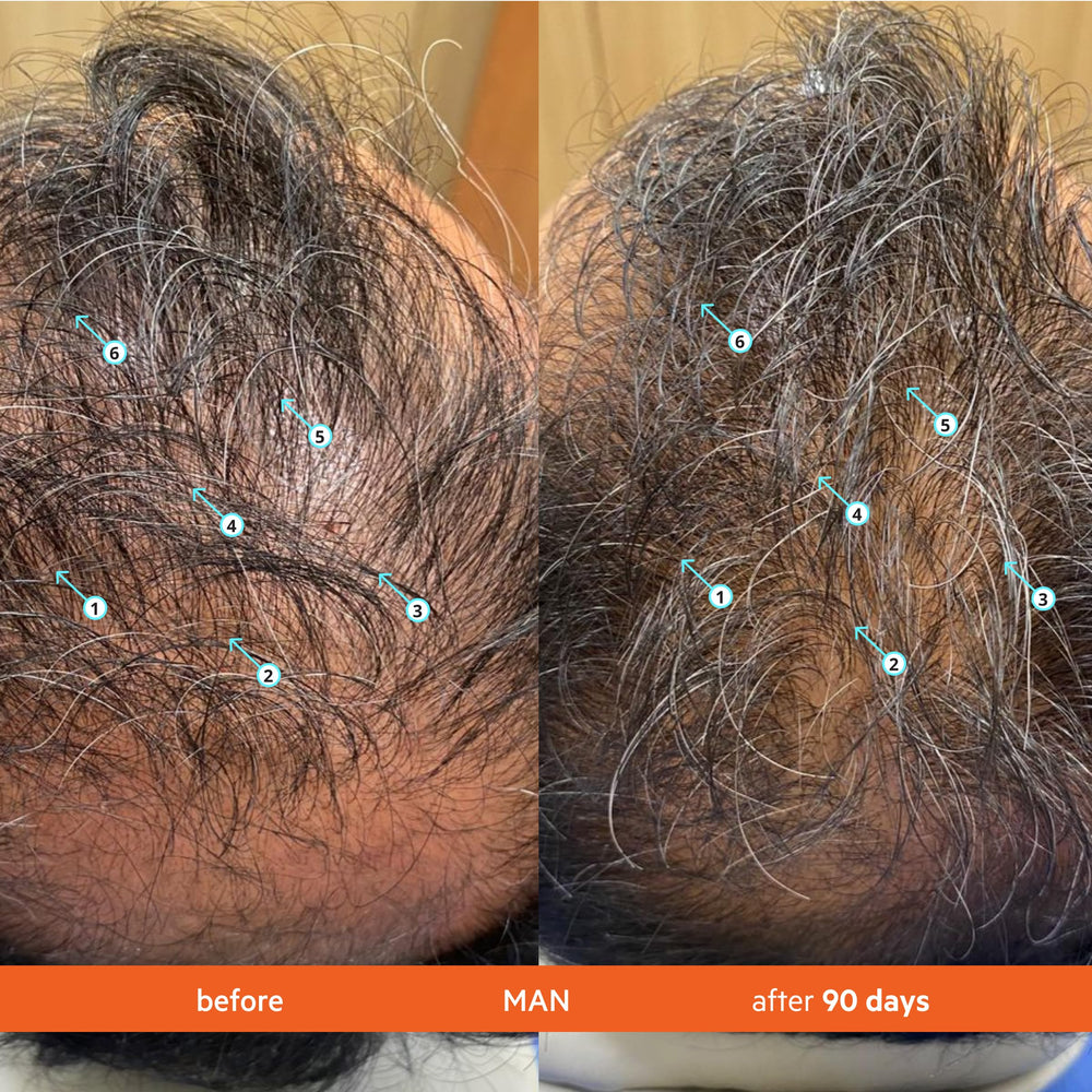 Texture-legere Revita-shampooing: sensation légère qui n'alourdit pas les cheveux.