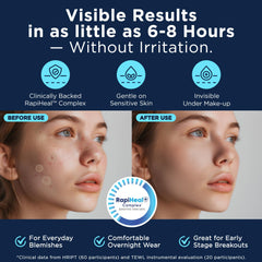 Patch Dura Cleanse adhère sans crème, application sans effort.