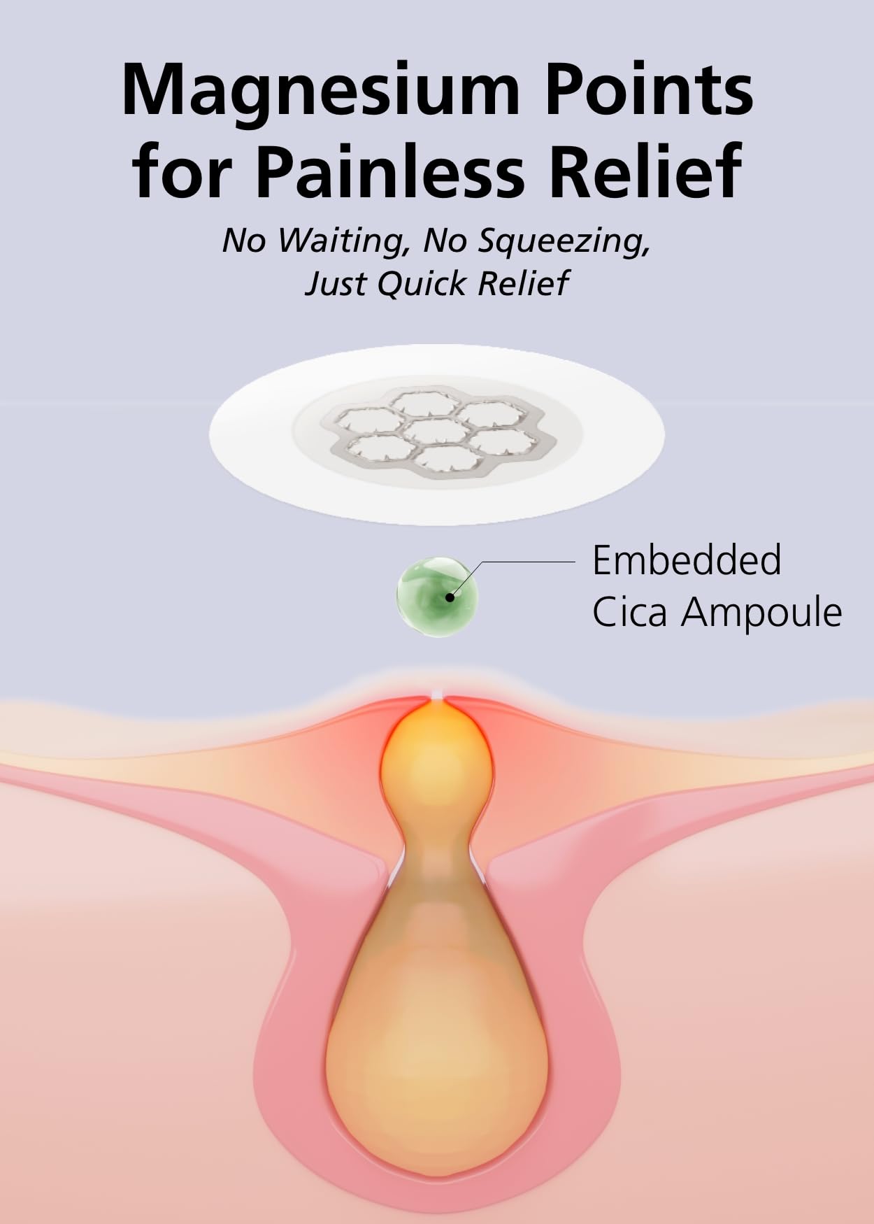 Boîte EasyDerm avec patchs hydrocolloïdes et outils inclus.
