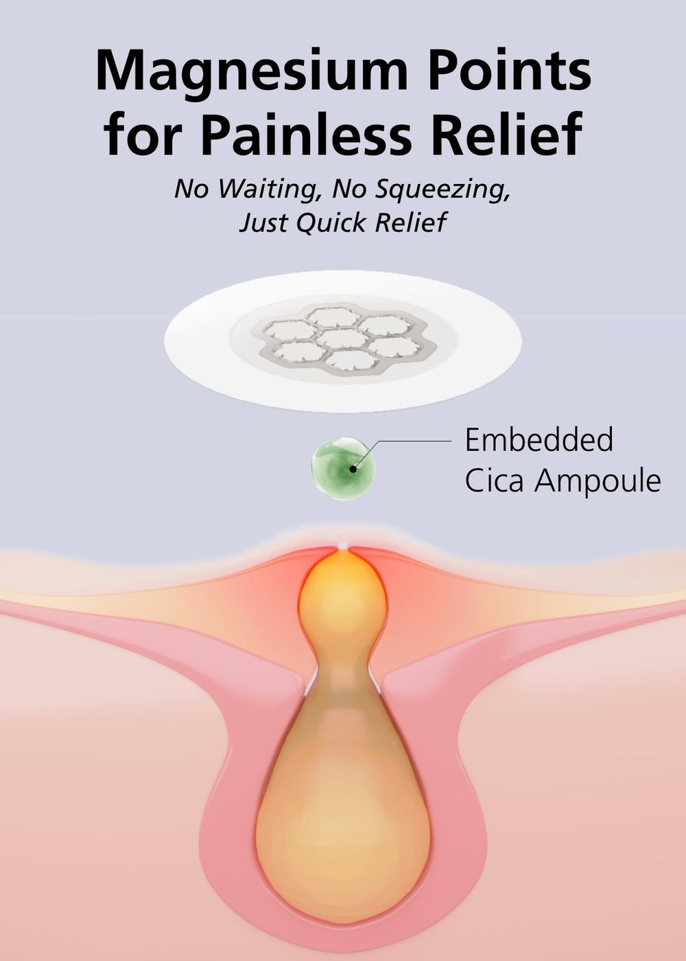 Boîte EasyDerm avec patchs hydrocolloïdes et outils inclus.