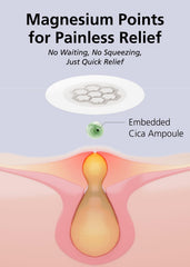 Boîte EasyDerm avec patchs hydrocolloïdes et outils inclus.