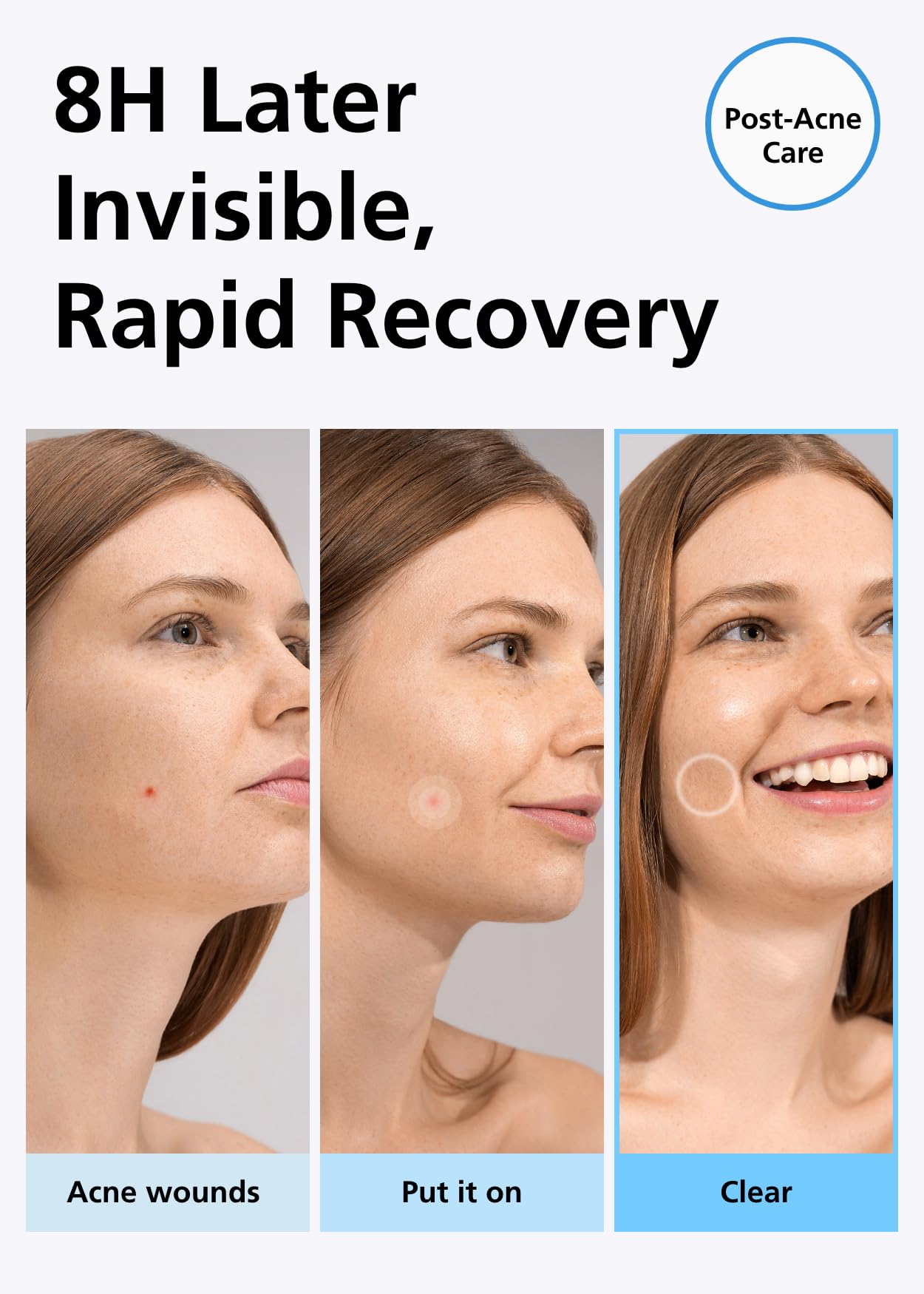 Application d'un patch sur un bouton du visage, approche ciblée.