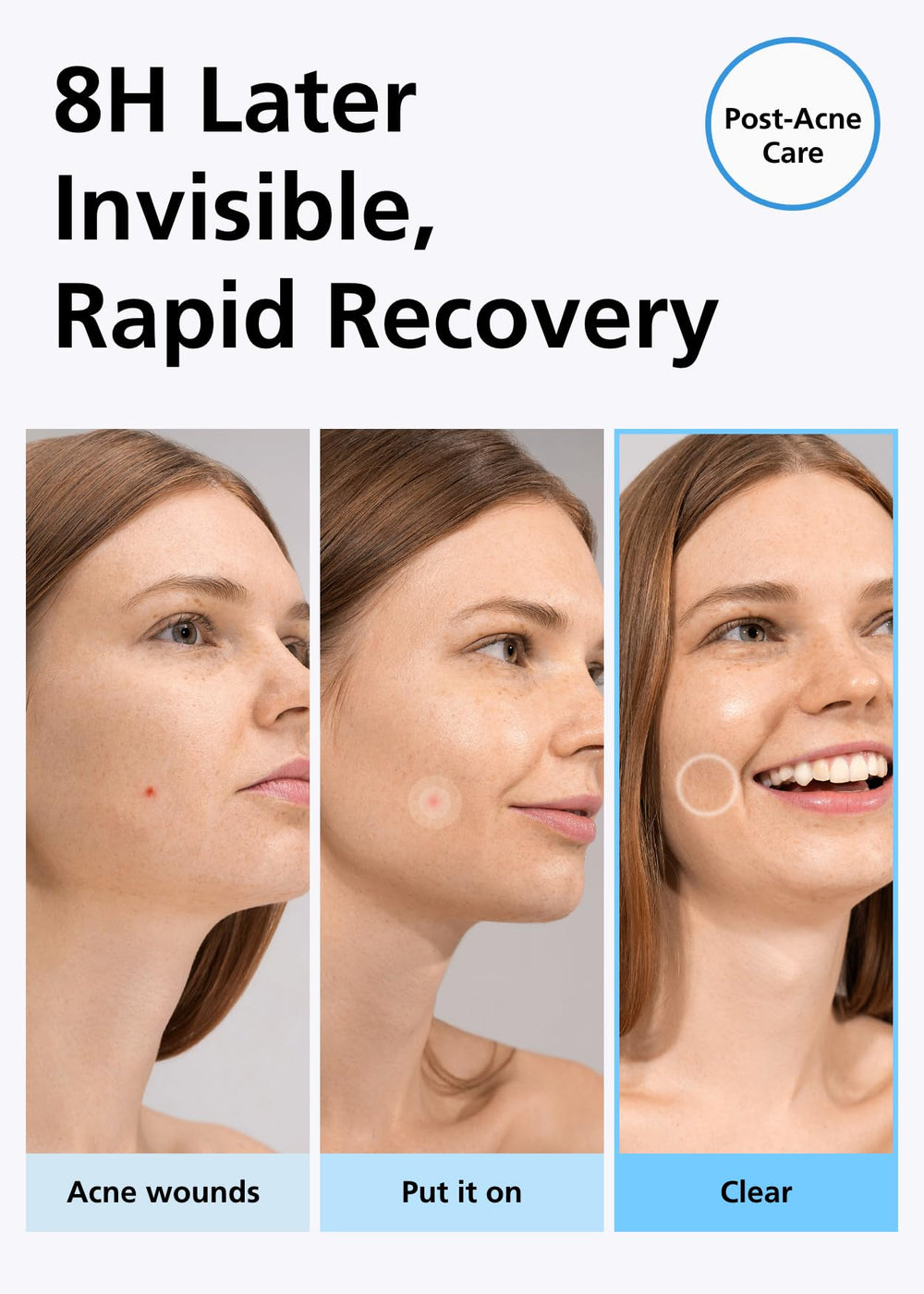 Application d'un patch sur un bouton du visage, approche ciblée.