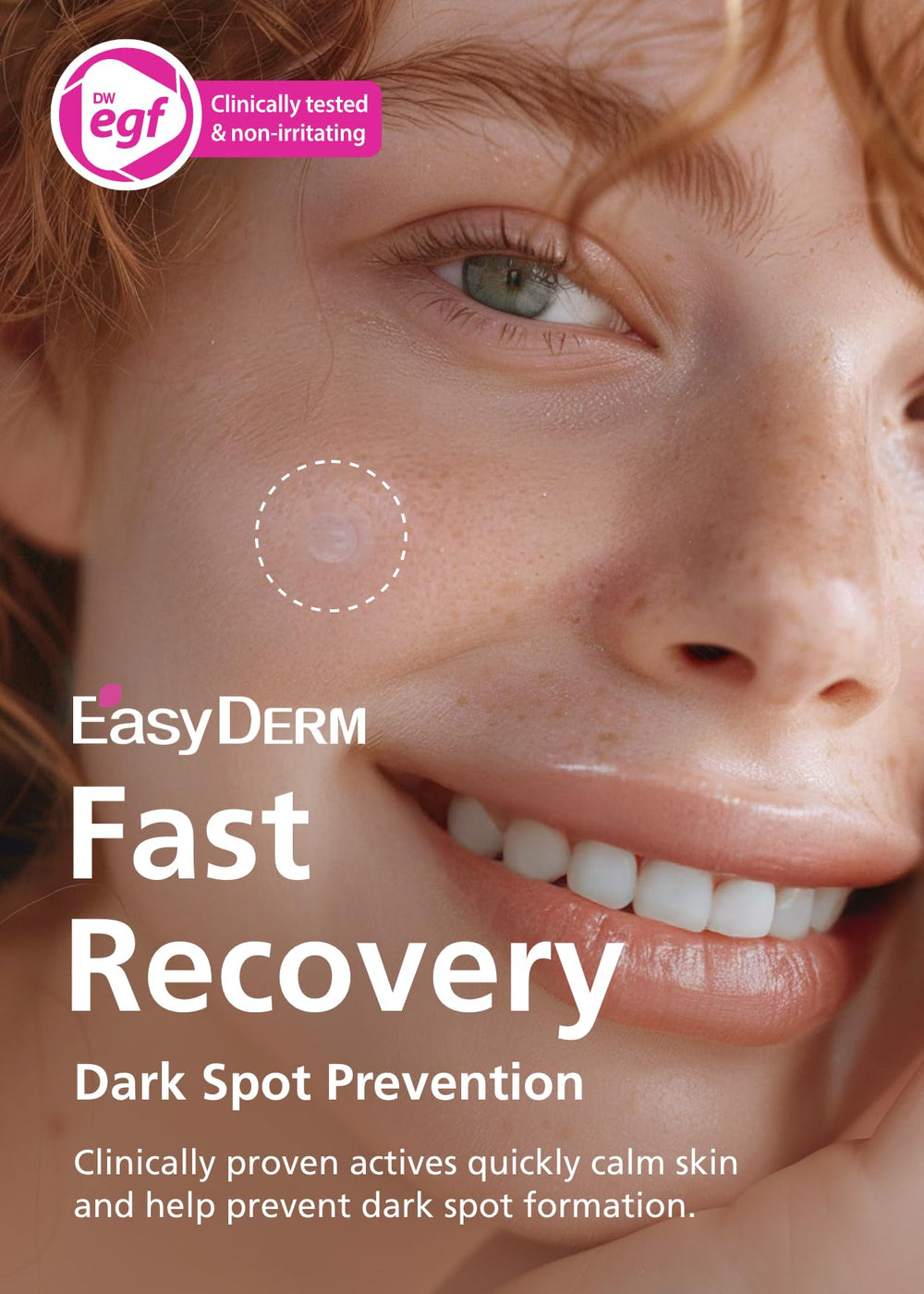 DWEasyDerm emballage-protection microdart : protection maximale pour préserver l'efficacité.