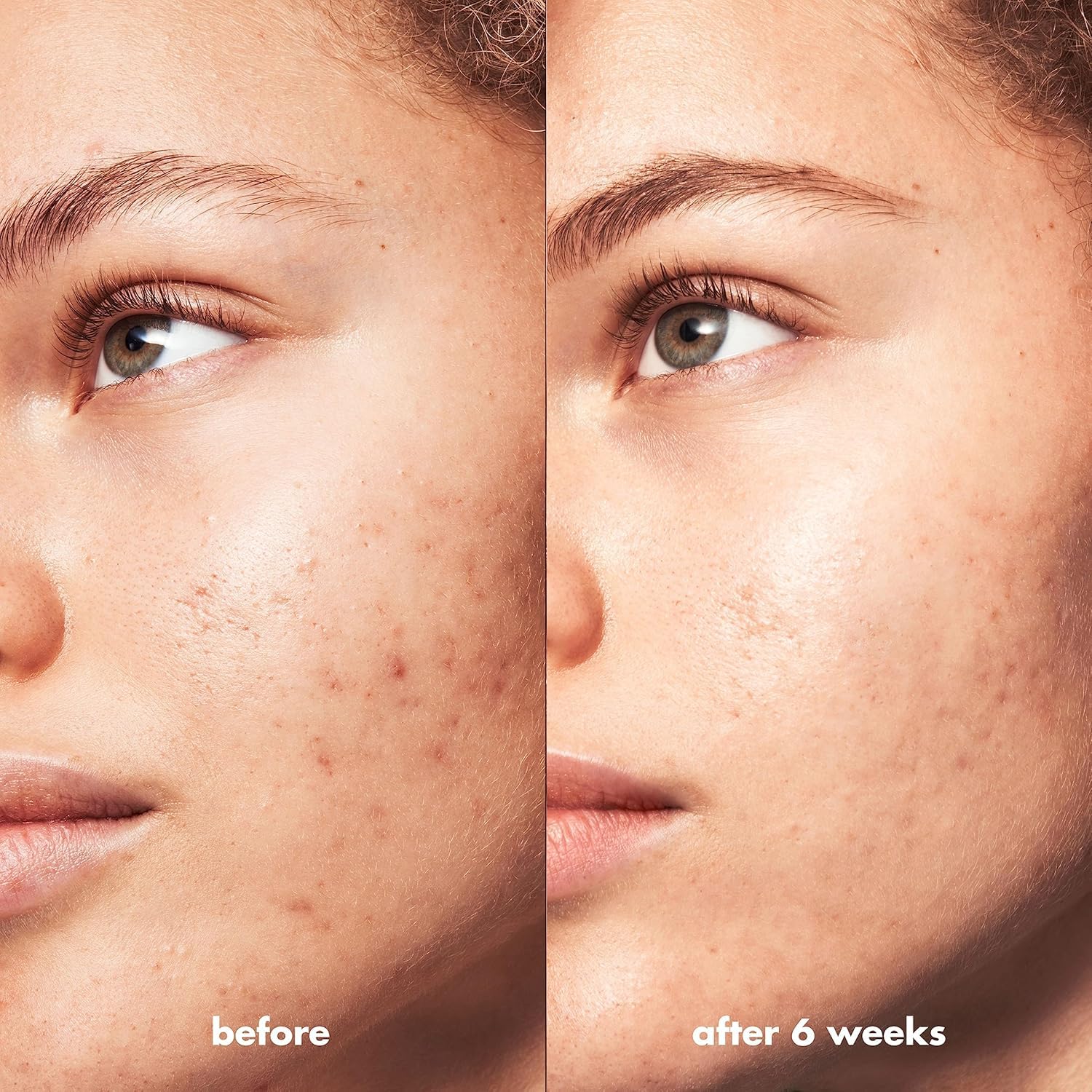 e.l.f. SKIN Blemish Breakthrough Clarifie les pores lors du nettoyage quotidien.