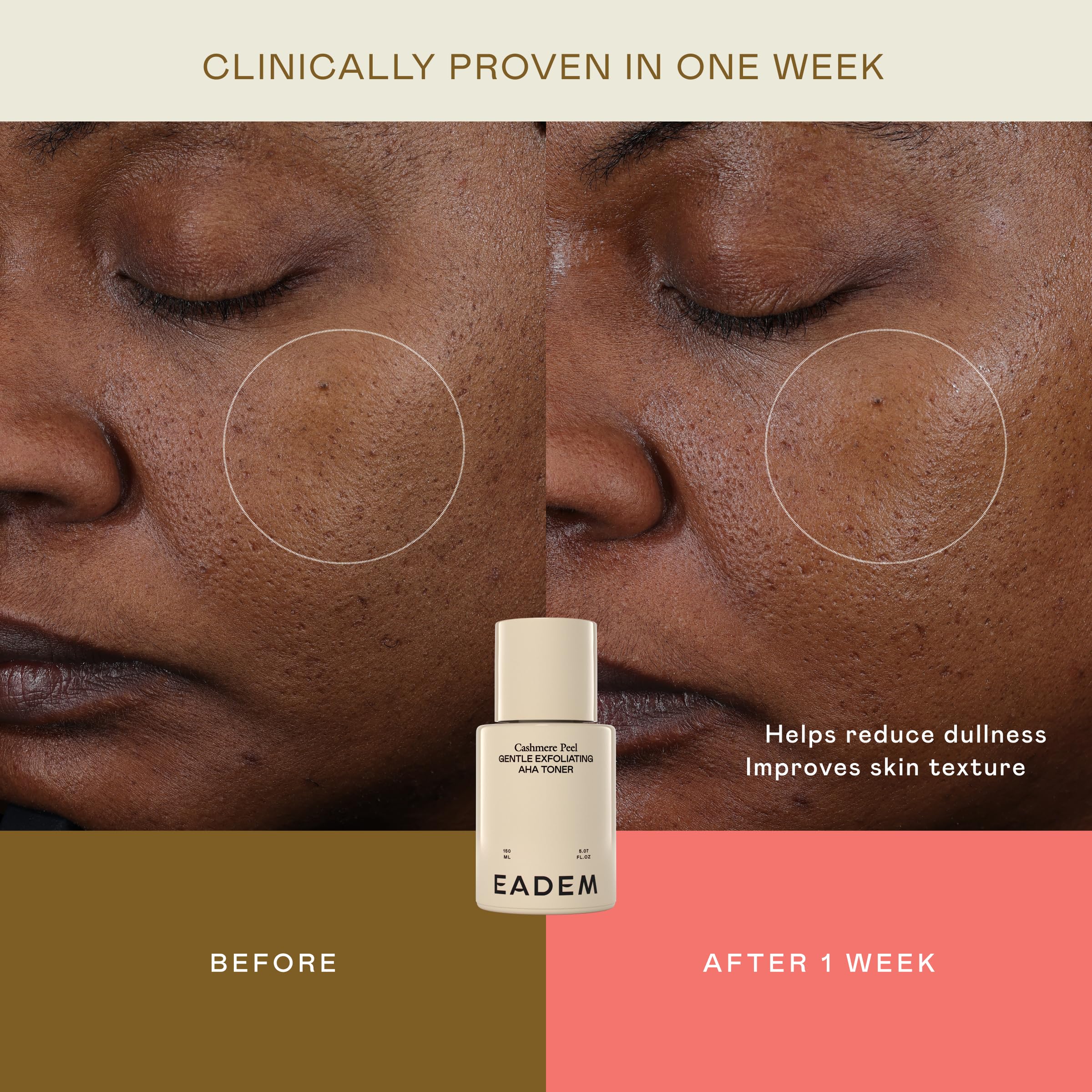 Hydratation légère après exfoliation avec EADEM Cashmere Peel.