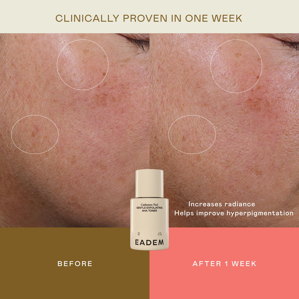 Pores affinés grâce au tonique EADEM Cashmere Peel.