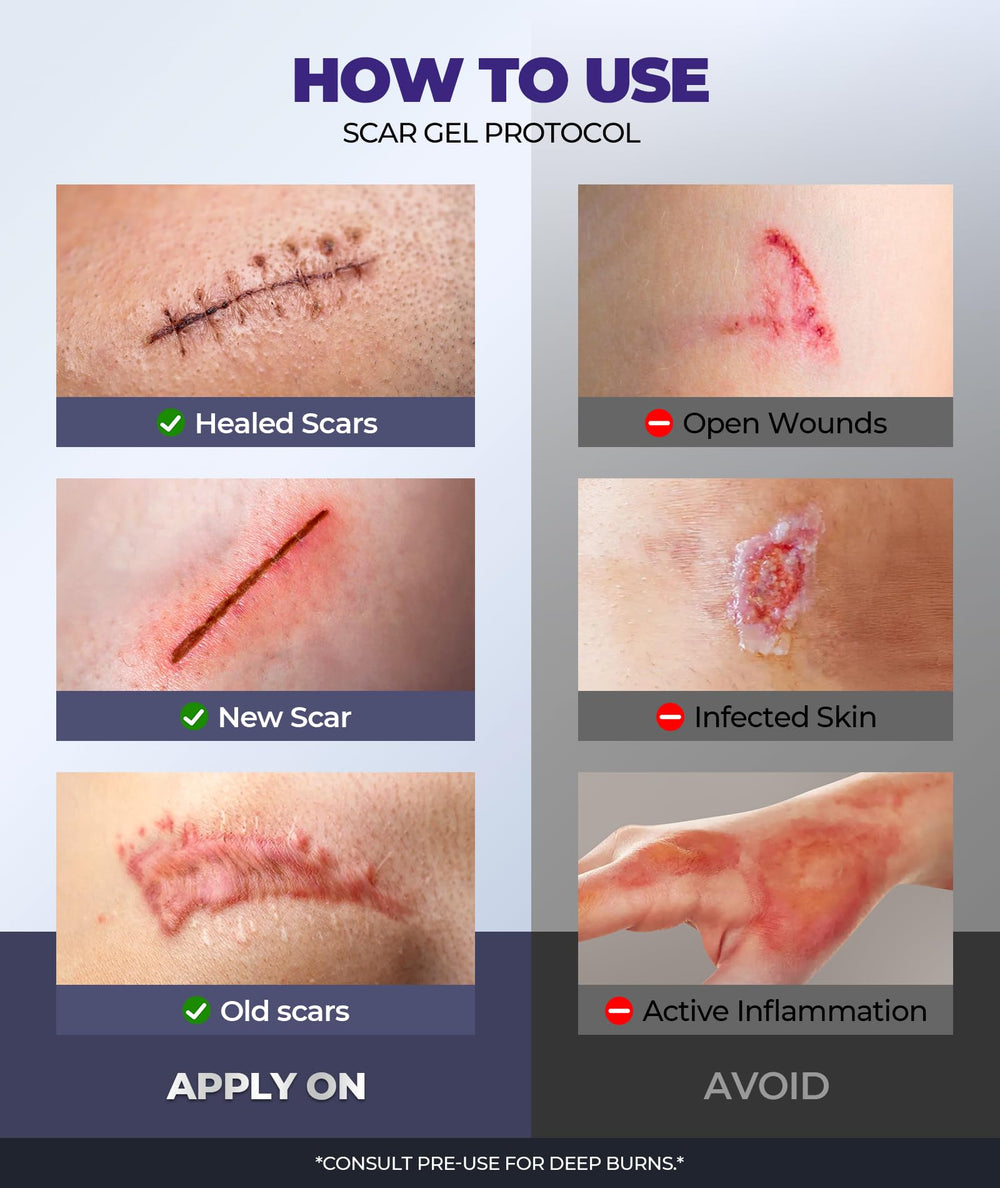 Easewave cicatrices et vergetures routine de soin polyvalente