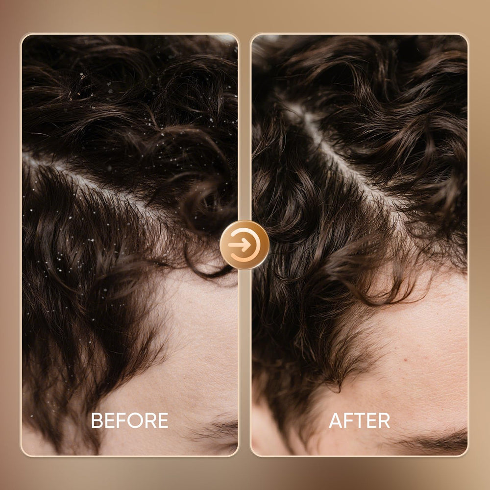 Easyes Shampoing Anti-Pellicules infusion gingembre-thuja pour revitaliser les cheveux.