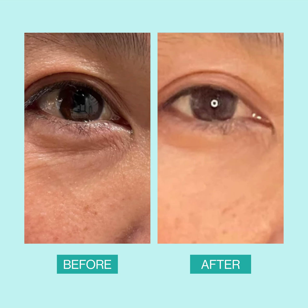 eb5 Daily Repair Eye Treatment — vitamine E pour protection et éclat du regard