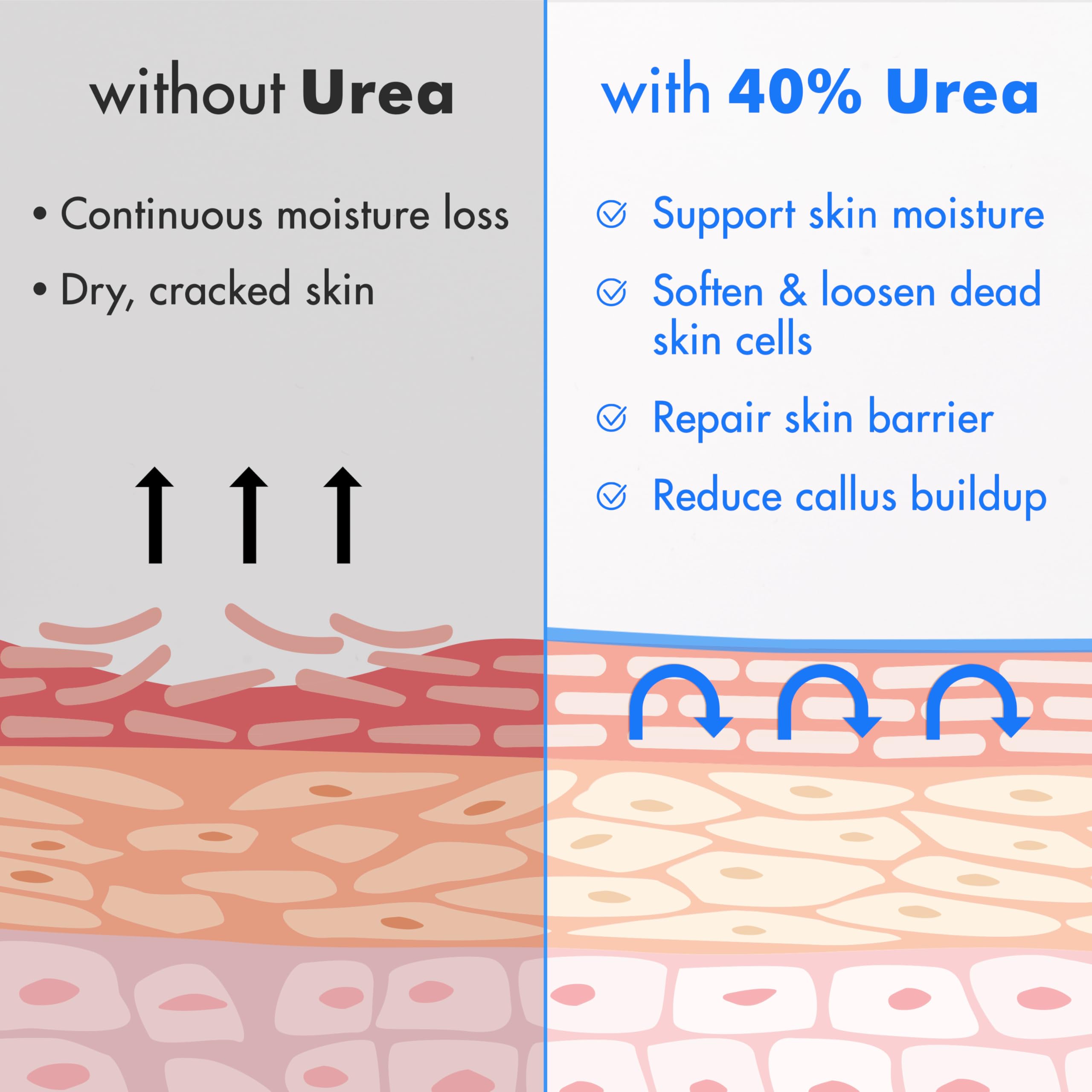 Ebanel Urea 40% crème et ingrédients clés: karité, coco, jojoba et Aloe vera.