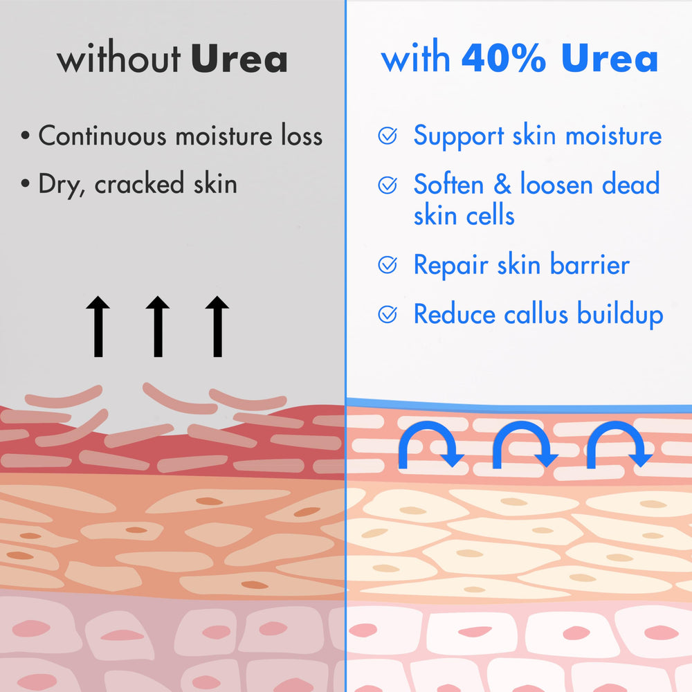 Ebanel Urea 40% crème et ingrédients clés: karité, coco, jojoba et Aloe vera.