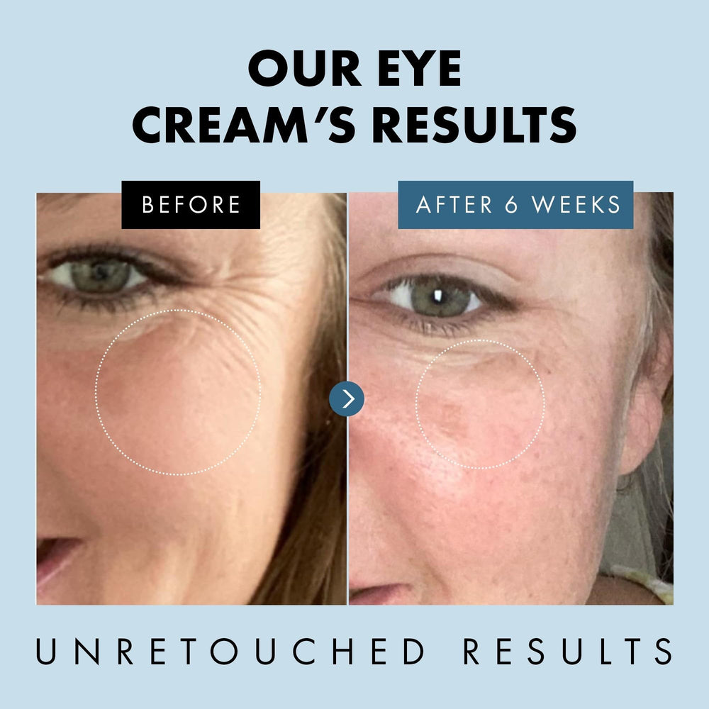 Application contour des yeux avec Eclat Skincare, geste précis.