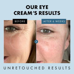 Application contour des yeux avec Eclat Skincare, geste précis.