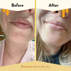 Application sur les lèvres, baume Eczema Honey offre une sensation douce.