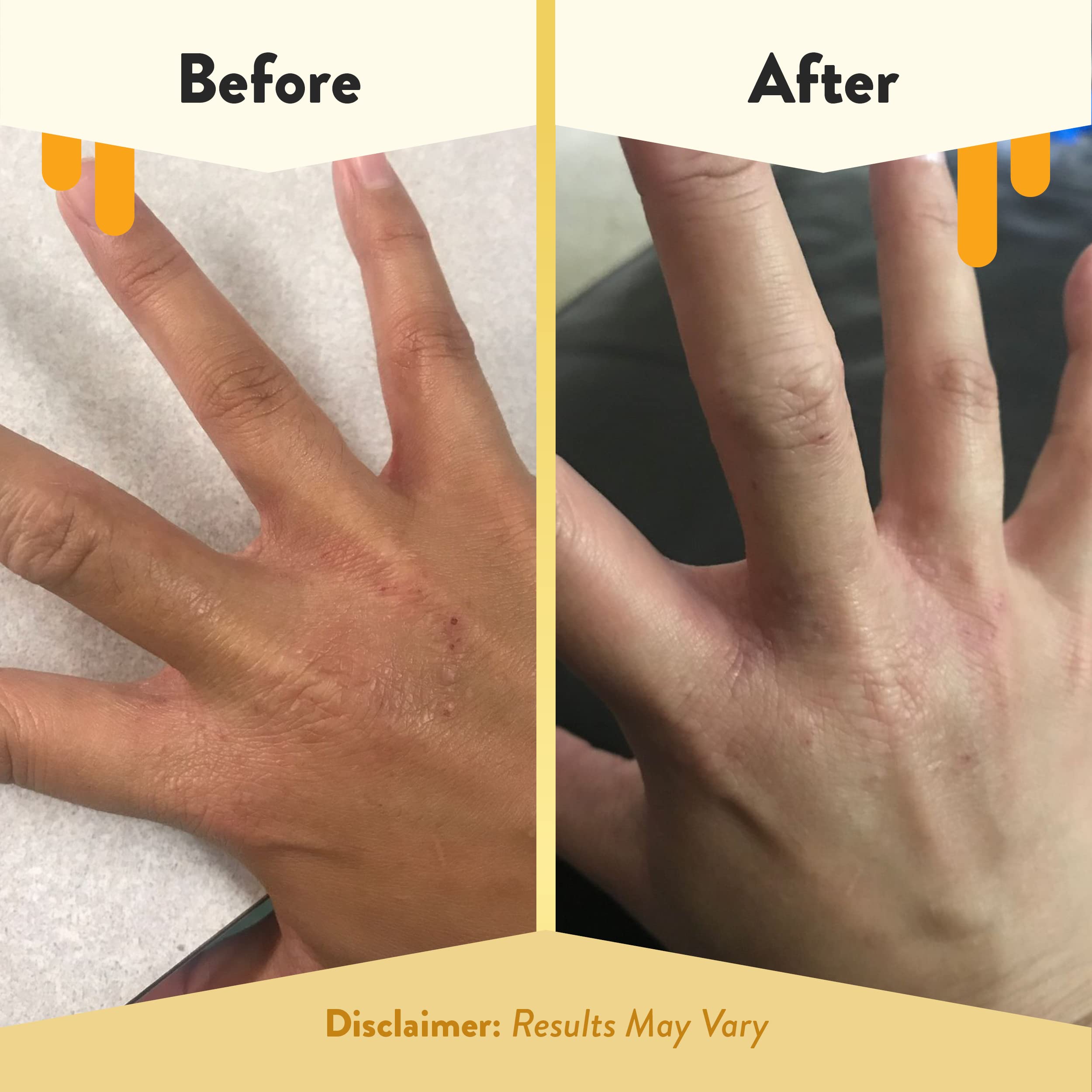 ECZEMA HONEY après-rasage apaisant réduit les irritations
