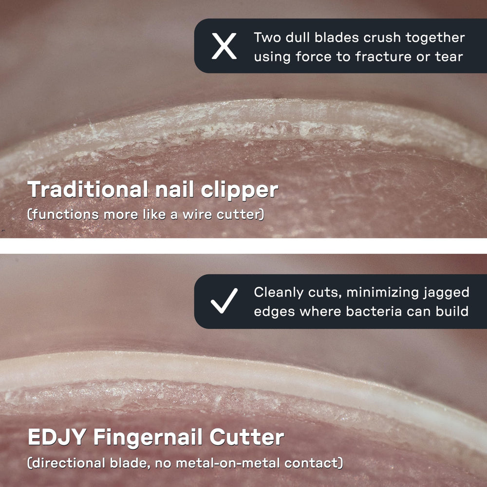 EDJY stop sécurité : protège l’ongle et évite de couper trop court.