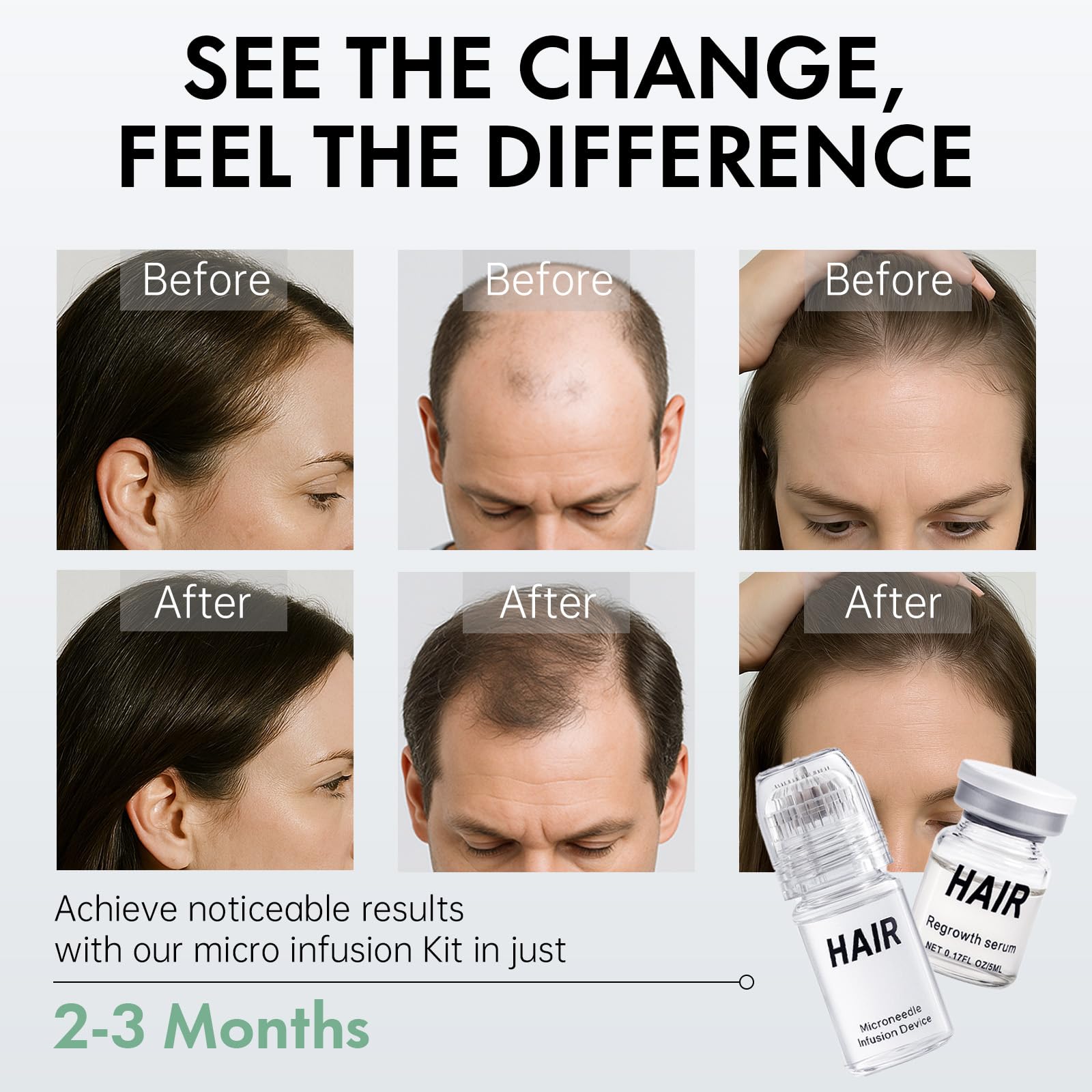 EELHOE traitement infusion micro favorisant l’absorption des sérums sur cheveux.