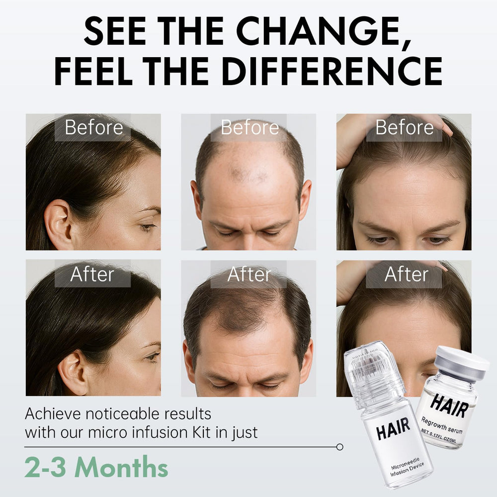 EELHOE traitement infusion micro favorisant l’absorption des sérums sur cheveux.