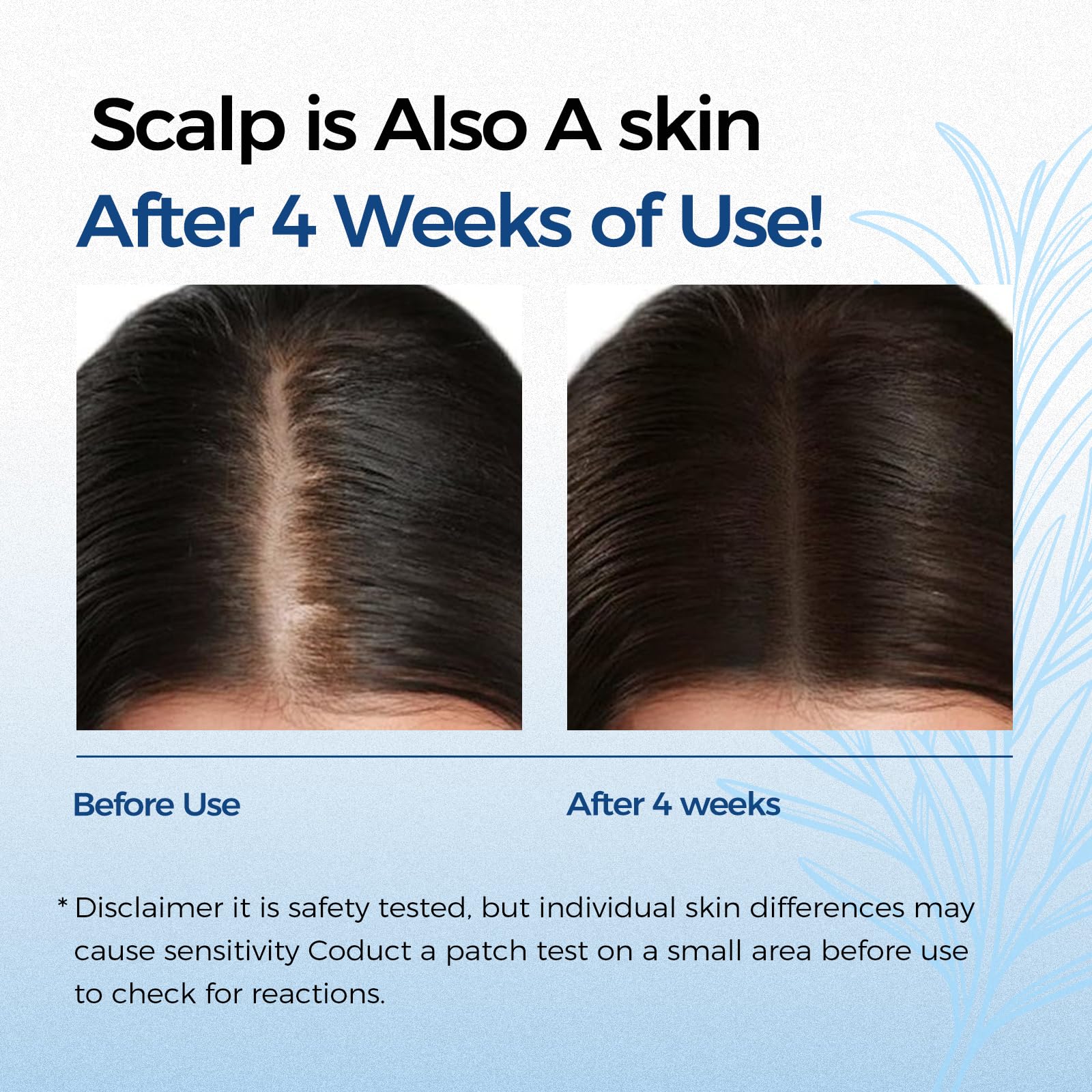 EELEAN Sérum croissance capillaire Roll-On, application précise sur cuir chevelu pour densité potentielle