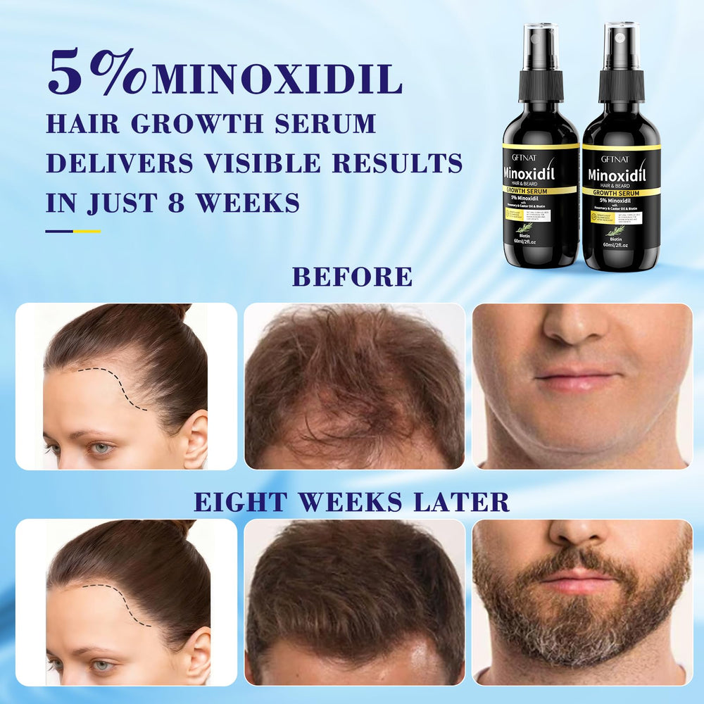 Elegra Minoxidil — atomiseur facilitant l’application sur de grandes zones