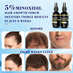 Elegra Minoxidil — atomiseur facilitant l’application sur de grandes zones