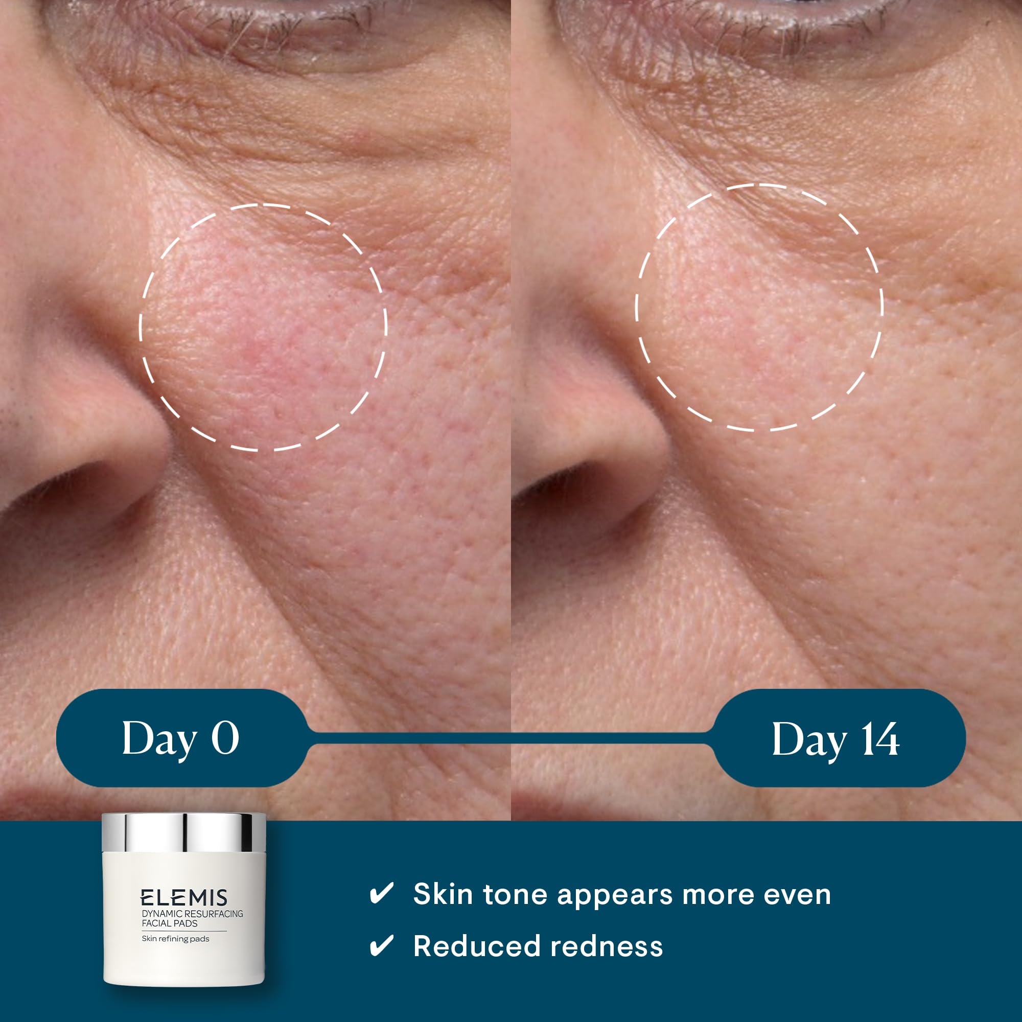 ELEMIS Dynamic Resurfacing Pads — pot 60 cotons pour exfolier en douceur.
