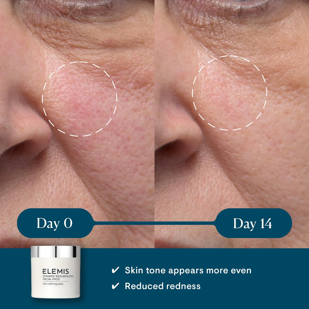 ELEMIS Dynamic Resurfacing Pads — pot 60 cotons pour exfolier en douceur.