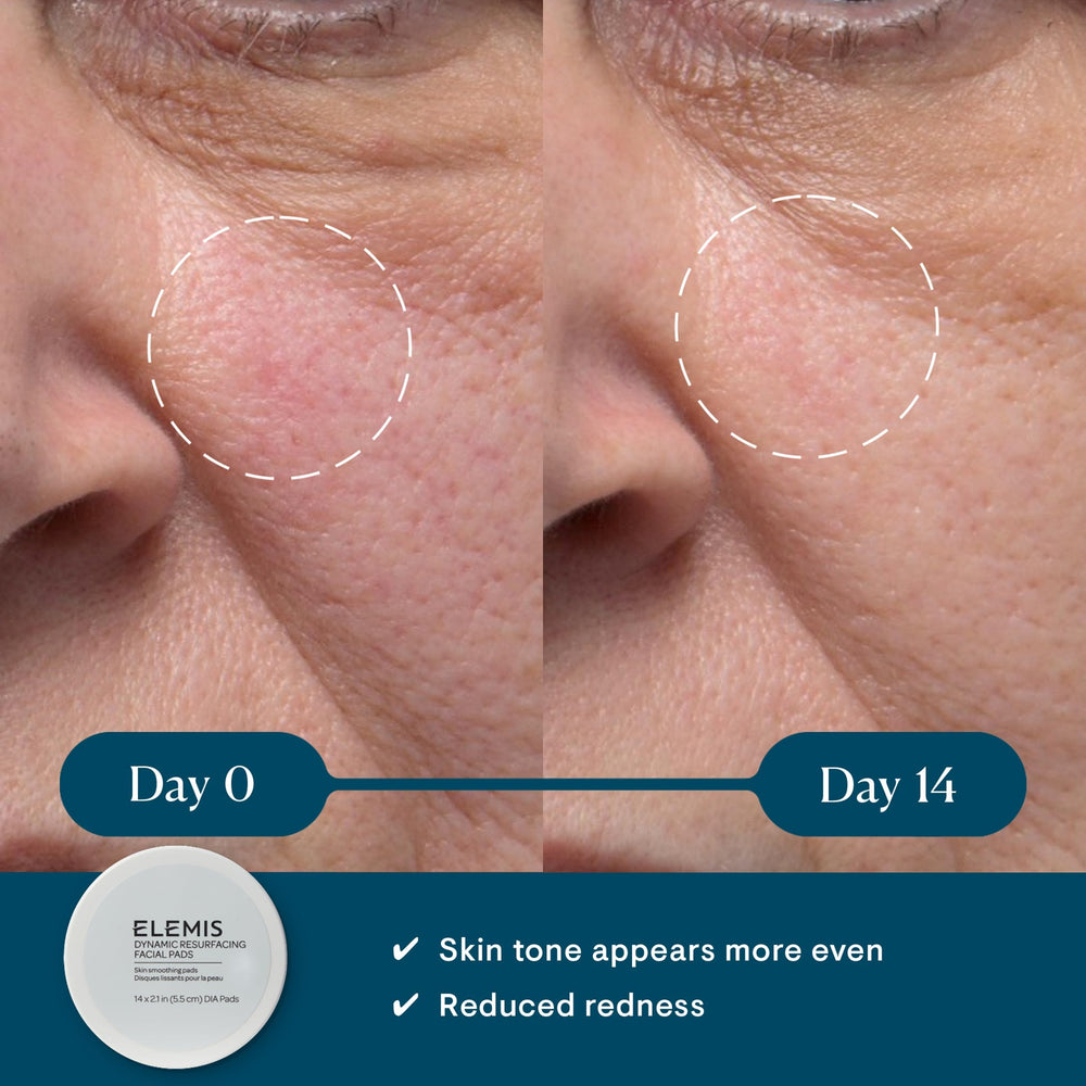 ELEMIS Dynamic Resurfacing Pads: face-texturee, exfoliation douce pour teint uniforme.