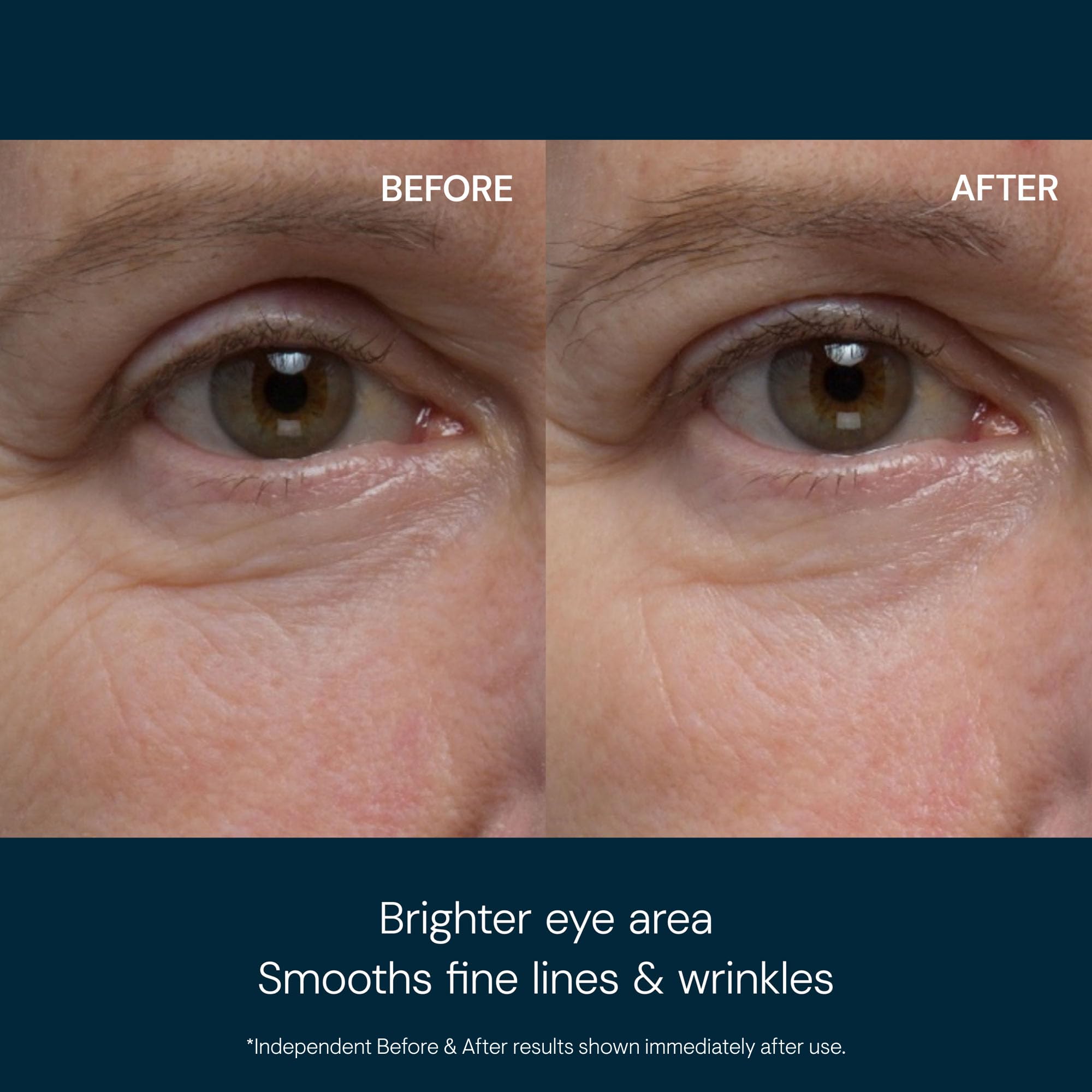 ELEMIS Pro-Collagen Eye Revive Mask – gel frais dégonflant les poches autour des yeux