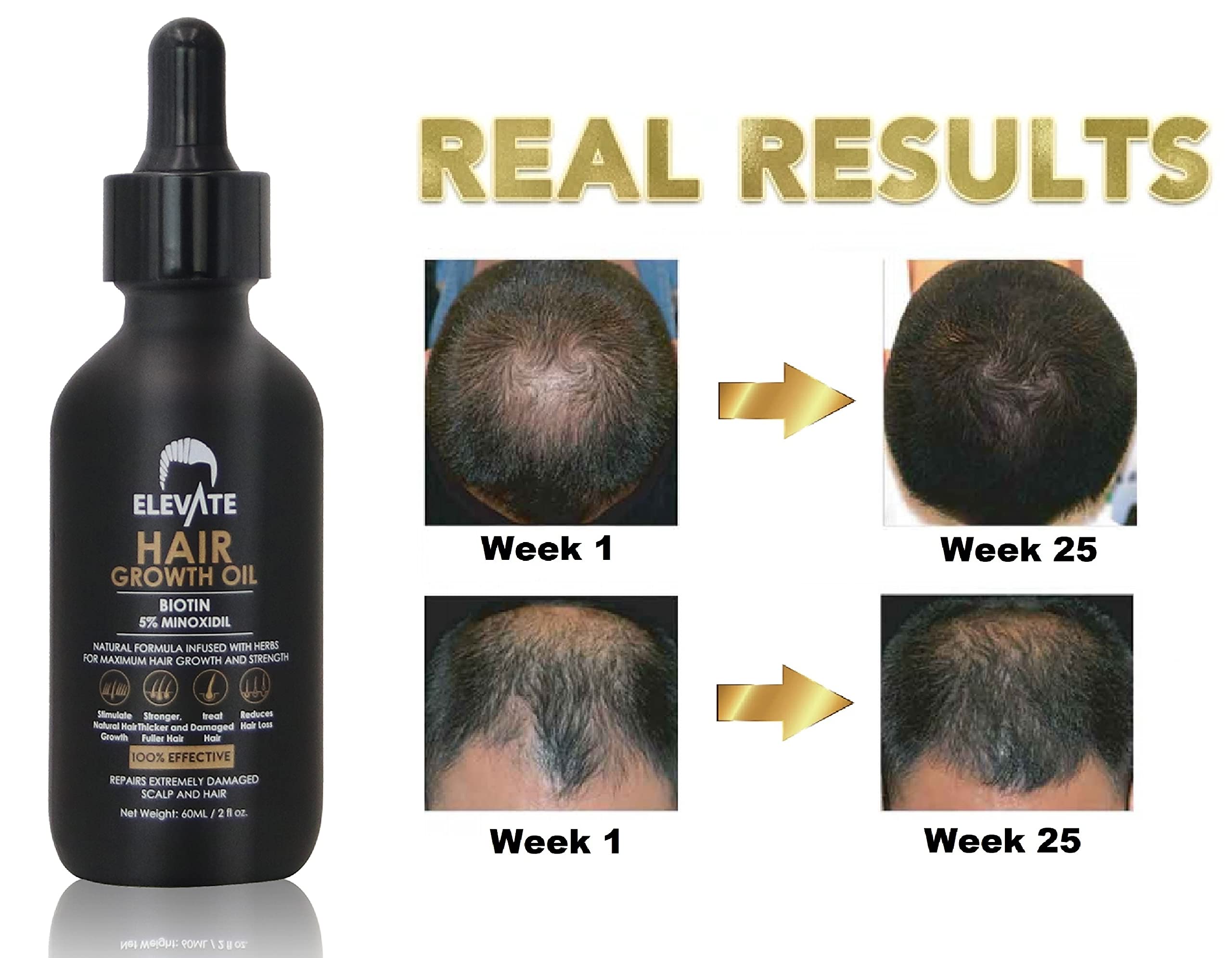 Elevate formule sans parabènes et sans sulfates pour cuir chevelu sensible.