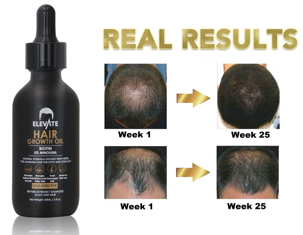 Elevate formule sans parabènes et sans sulfates pour cuir chevelu sensible.