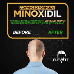 Elevate minoxidil spray applied to scalp showing targeted use