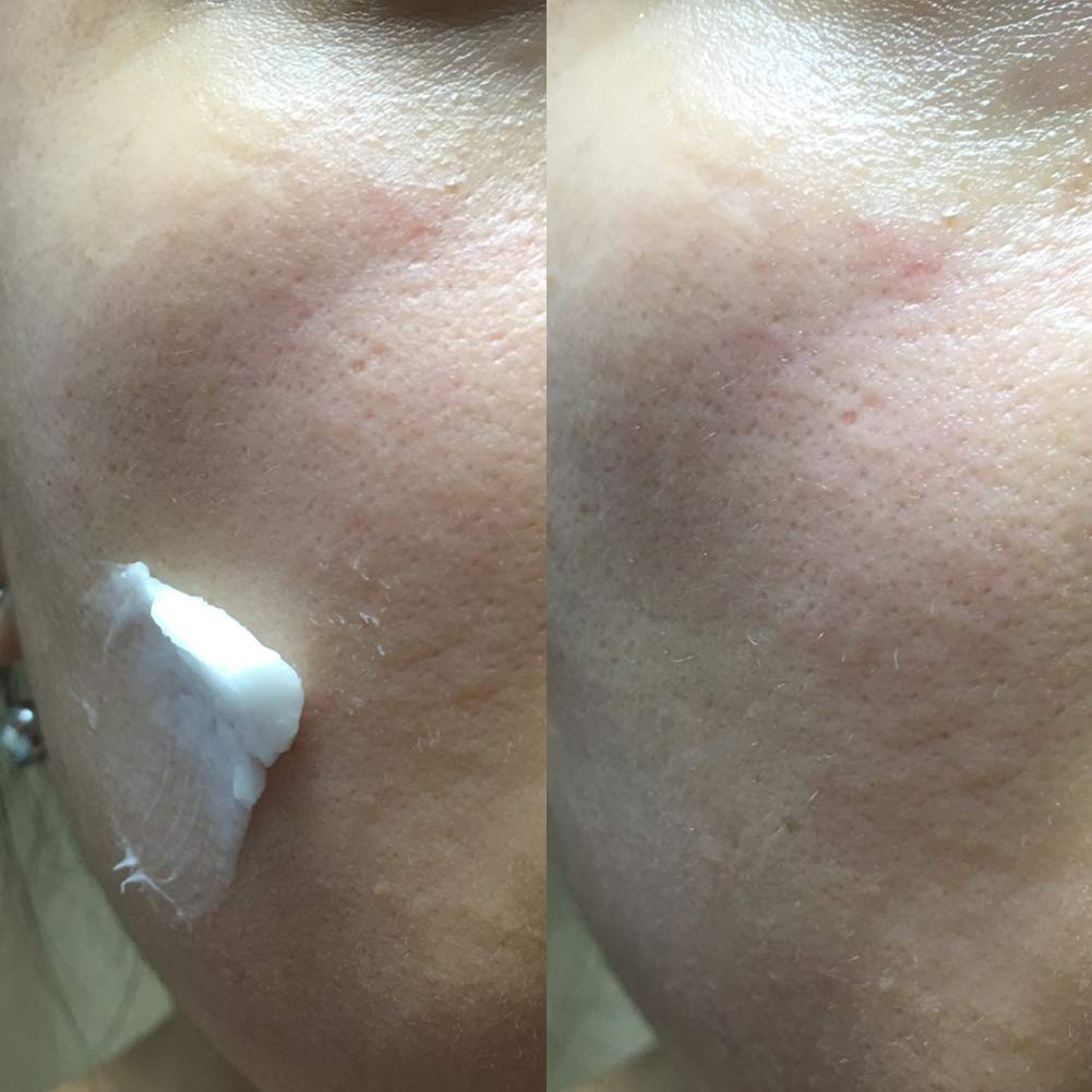 Niacinamide dans la formule Elizavecca Crème lait-âne vapeur.