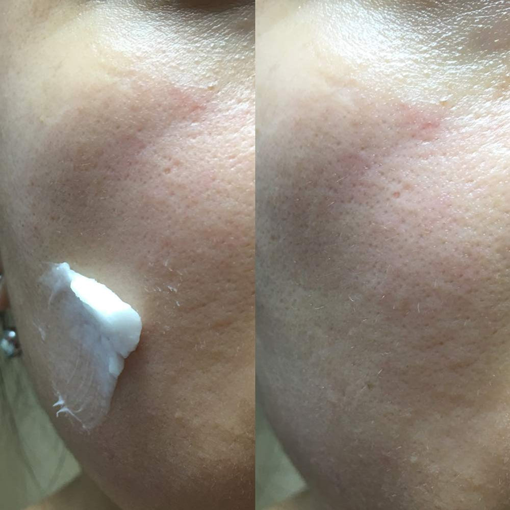 Niacinamide dans la formule Elizavecca Crème lait-âne vapeur.