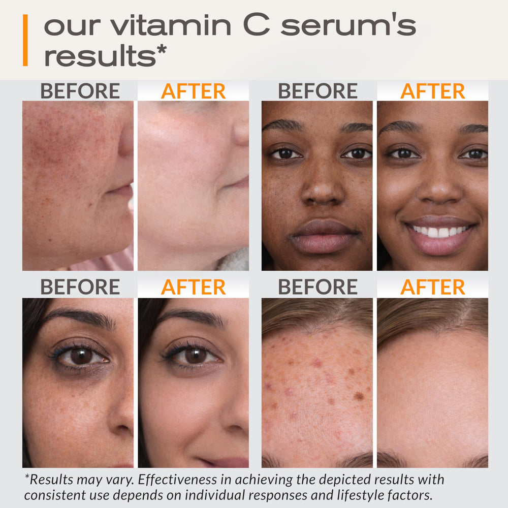Ella & Eden Sérum vitamine C – texture soyeuse pour peau douce.