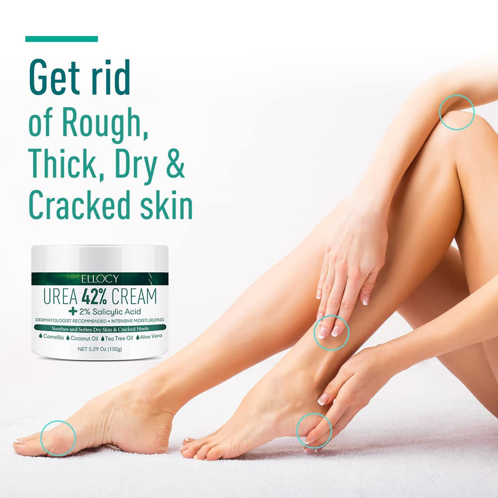 Pieds plus doux après usage régulier d'Ellocy Crème Urea 40%.