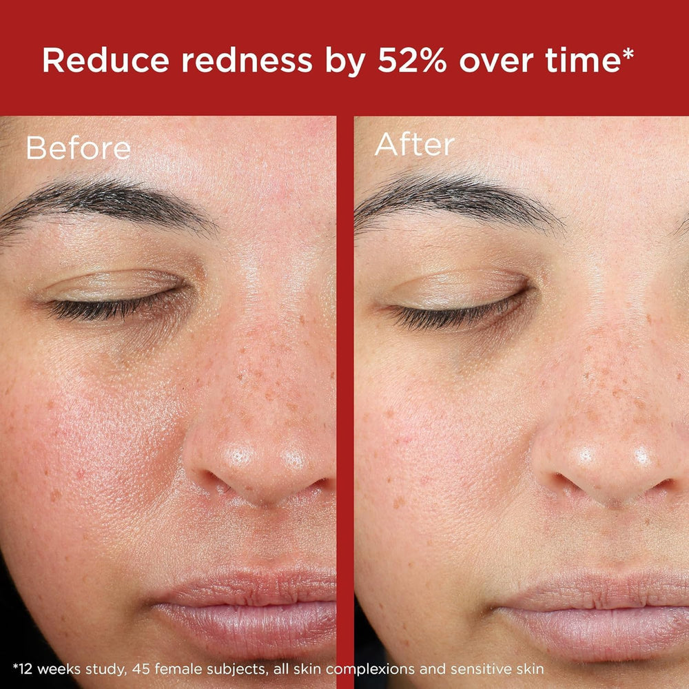 EltaMD UV Skin Recovery, teinte verte: correction visuelle et protection quotidienne du visage.